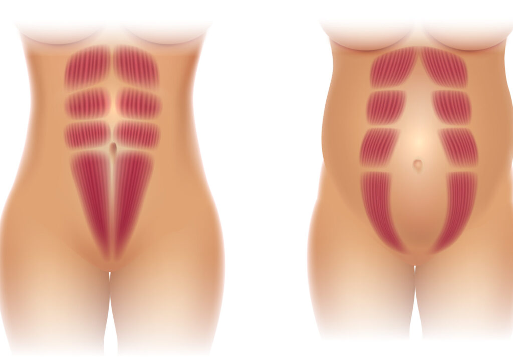 Consecuencias del crecimiento de la barriga en el embarazo